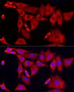 SLC25A11 Antibody in Immunocytochemistry (ICC/IF)