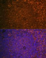 Cystatin F Antibody in Immunohistochemistry (Paraffin) (IHC (P))