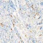 TCCR Antibody in Immunohistochemistry (Paraffin) (IHC (P))