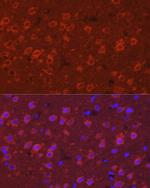 SYT11 Antibody in Immunocytochemistry (ICC/IF)