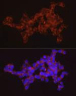 SYT11 Antibody in Immunocytochemistry (ICC/IF)