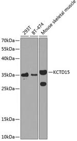 KCTD15 Antibody in Western Blot (WB)