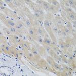 Securin Antibody in Immunohistochemistry (Paraffin) (IHC (P))