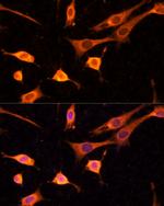 BFAR Antibody in Immunocytochemistry (ICC/IF)