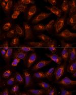 BFAR Antibody in Immunocytochemistry (ICC/IF)