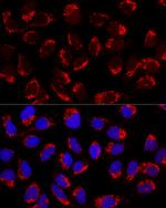 AP1M2 Antibody in Immunocytochemistry (ICC/IF)