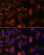 CAD Antibody in Immunocytochemistry (ICC/IF)