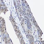 XPC Antibody in Immunohistochemistry (Paraffin) (IHC (P))