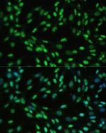 UAP56 Antibody in Immunocytochemistry (ICC/IF)