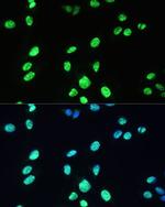 UAP56 Antibody in Immunocytochemistry (ICC/IF)