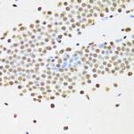 UAP56 Antibody in Immunohistochemistry (Paraffin) (IHC (P))