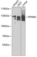 SAPS2 Antibody in Western Blot (WB)