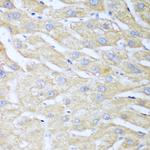 NUDT15 Antibody in Immunohistochemistry (Paraffin) (IHC (P))