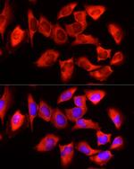 YTHDF3 Antibody in Immunocytochemistry (ICC/IF)