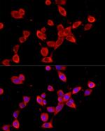 YTHDF3 Antibody in Immunocytochemistry (ICC/IF)