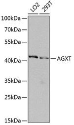 AGXT Antibody in Western Blot (WB)