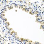 BMP5 Antibody in Immunohistochemistry (Paraffin) (IHC (P))