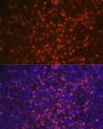 CD21 Antibody in Immunohistochemistry (Paraffin) (IHC (P))