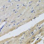 FECH Antibody in Immunohistochemistry (Paraffin) (IHC (P))