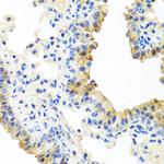 FECH Antibody in Immunohistochemistry (Paraffin) (IHC (P))