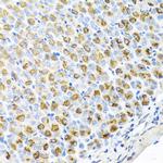 FECH Antibody in Immunohistochemistry (Paraffin) (IHC (P))