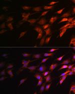 NF-H Antibody in Immunocytochemistry (ICC/IF)