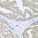 TIMM10B Antibody in Immunohistochemistry (Paraffin) (IHC (P))