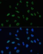 MKL1 Antibody in Immunocytochemistry (ICC/IF)