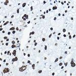 MKL1 Antibody in Immunohistochemistry (Paraffin) (IHC (P))