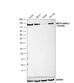 MKL1 Antibody in Western Blot (WB)