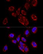 TEFM Antibody in Immunocytochemistry (ICC/IF)