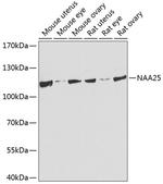 C12orf30 Antibody in Western Blot (WB)