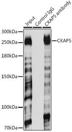 CKAP5 Antibody in Immunoprecipitation (IP)