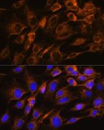 Aquaporin 8 Antibody in Immunocytochemistry (ICC/IF)