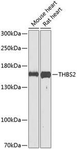 Thrombospondin 2 Antibody in Western Blot (WB)