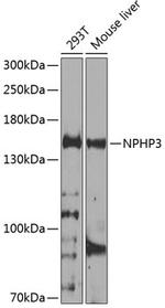 NPHP3 Antibody in Western Blot (WB)