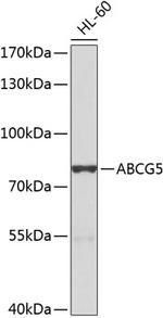 ABCG5 Antibody in Western Blot (WB)