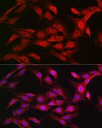 Importin beta-1 Antibody in Immunocytochemistry (ICC/IF)