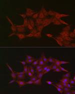 Importin beta-1 Antibody in Immunocytochemistry (ICC/IF)