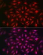 Importin beta-1 Antibody in Immunocytochemistry (ICC/IF)