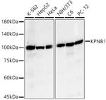 Importin beta-1 Antibody in Western Blot (WB)