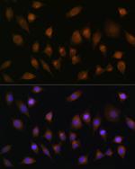 SNX1 Antibody in Immunocytochemistry (ICC/IF)