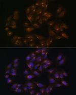 SNX1 Antibody in Immunocytochemistry (ICC/IF)