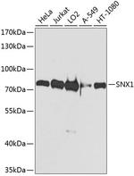SNX1 Antibody in Western Blot (WB)