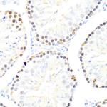 DDX50 Antibody in Immunohistochemistry (Paraffin) (IHC (P))