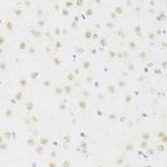 DDX50 Antibody in Immunohistochemistry (Paraffin) (IHC (P))