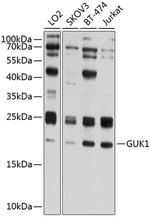 GUK1 Antibody in Western Blot (WB)