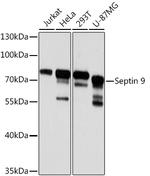 Septin-9 Antibody in Western Blot (WB)