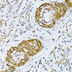 VAMP1 Antibody in Immunohistochemistry (Paraffin) (IHC (P))