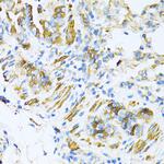 VAMP1 Antibody in Immunohistochemistry (Paraffin) (IHC (P))